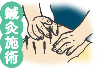 鍼灸施術